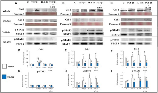 Effects of TGF-β1 and/or IL-6/sIL-6R with or without inhibition of STAT3 activation by S3I-201 on Col I protein expression. (A–C) Representative photomicrograph of western blot analysis for Col I, total protein (Ponceau S staining), p-STAT3 and STAT3 in the ESCs-healthy (A), ESCs-endo (B) and Ectopic-ESCs (C) groups. (D–F) Relative expression level of Col I in the ESCs-healthy (D), ESCs-endo (E) and Ectopic-ESCs (F) groups. Signal intensities were normalized to total protein (Ponceau S staining). (G–I) Relative expression levels of p-STAT3 in the ESCs-healthy (G), ESCs-endo (H) and Ectopic-ESCs (I) groups. Total and phosphorylated form levels were normalized to total protein, and the ratio of phosphorylated form/total level was calculated. C, control (vehicle alone: PBS); Ectopic-ESCs, endometriotic stromal cells; ESCs, endometrial stromal cells; ESCs-endo, ESCs from patients with endometriosis; ESCs-healthy, ESCs from healthy women; IL-6/R, IL-6/soluable IL-6 receptor; S3I-201, STAT3 inhibitor; V, vehicle (DMSO for S3I-201) alone. ESCs-healthy: n = 6. ESCs-endo: n = 8. Ectopic-ESCs: n = 8. Numerical values are presented as the mean ± SD. *P < 0.05: versus Control. ¶P < 0.05: versus IL-6/sIL-6R or IL-6/sIL-6R+ TGF-β1 treated group. #P < 0.05: vehicle (DMSO for S3I-201) alone versus S3I-201.