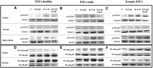 Representative photomicrograph of western blot analysis: effects of stimulation by TGF-β1 and/or IL-6/sIL-6R with or without inhibition of STAT3 activation by S3I-201 or BMS-345541 on activation of STAT3 and NF-κB p65. (A, D) ESCs-healthy. (B, E) ESCs-endo. (C, F) Ectopic-ESCs. BMS-345541, NF-κB inhibitor; C, control (vehicle alone: PBS); Ectopic-ESCs, endometriotic stromal cells; ESCs, endometrial stromal cells; ESCs-endo, ESCs from patients with endometriosis; ESCs-healthy, ESCs from healthy women; IL-6/R, IL-6/soluable IL-6 receptor; S3I-201, STAT3 inhibitor; V, vehicle (DMSO for S3I-201 or BMS-345541) alone. ESCs-healthy: n = 6. ESCs-endo: n = 8. Ectopic-ESCs: n = 8.