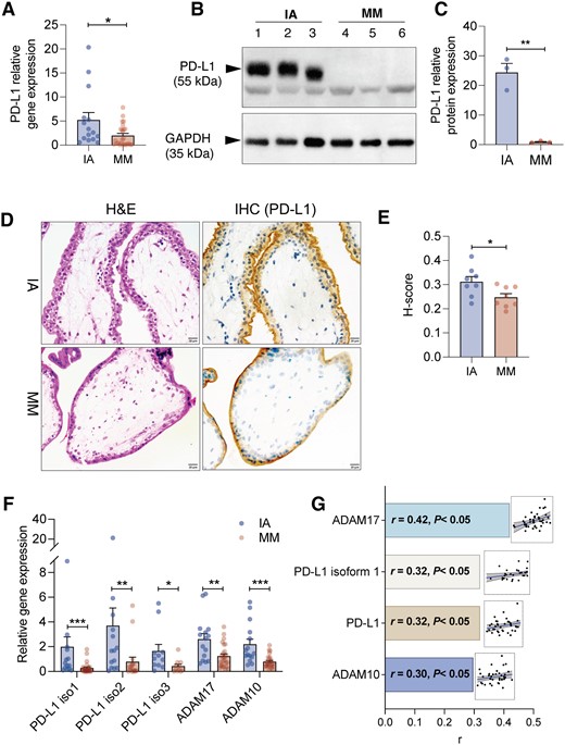 Placental PD-L1 expression is significantly attenuated in patients with miscarriage. (A) The relative gene expression level of PD-L1 in placenta in the induced abortion (IA) group (n = 15) and missed miscarriage (MM) group (n = 25). (B) Western blot analysis and (C) grayscale analysis of PD-L1 expression in IA and MM groups. The placenta samples were collected from three different individuals in each group. (D) Representative image of immunohistochemistry (IHC) staining of PD-L1 expression in placenta samples from two groups. (E) Semi-quantified analysis of PD-L1 expression by IHC staining. The staining intensities were calculated as the ratio of the average sizes of the positive staining area and the count of nuclei from eight different images in each group. (F) The relative gene expression level of PD-L1 isoforms 1–3 and ADAM protease (ADAM17 and ADAM10) in the placenta (n = 15 in the IA group, n = 25 in the MM group). (G) Correlation analysis between serum sPD-L1 level (pg/ml) and log-transformed ΔCt value of PD-L1, PD-L1 isoform-1, ADAM17, and ADAM10. The relative expression level of PD-L1 genes was normalized by β-actin with 2ΔΔCt method). r was determined by Pearson correlation. *P < 0.05, **P < 0.01, ***P < 0.001 by two-tail unpaired Student’s t-test or Mann–Whitney test. Blue or brown dots indicated data from individual subjects in the IA or MM groups, respectively.