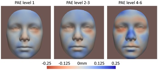 FDR (false discovery rate)-significant results of different levels of prenatal alcohol exposure (PAE), in Tier 2b, multi-ethnic group for 9-year-old children. Level 1: <12 g of alcohol per week, N = 887; Levels 2 and 3: 12–72 g per week, N = 546; Levels 4–6: >12 g per day, N = 79. Mothers who ever drank heavily (>72 g/day) were excluded in the dose–response assessment. Red areas refer to inward changes while blue areas refer to outward changes of the face with respect to the geometric center of the head.