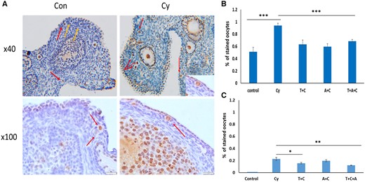 Temsirolimus and recombinant AMH decreased cyclophosphamide-induced DNA damage and apoptotic oocyte death. Ovary sections from (A) representative hematoxylin and eosin images of ovaries from control (Con, left) and Cyclophosphamide (Cy, right) treatment groups demonstrating positive (red arrows) and negative (yellow arrows) phosphorylated form of histone 2AX (γH2AX) staining. (B) Ovaries removed 12h, or (C) 24 h after Cy (also C) treatment, were stained for DNA damage using γH2AX antibody, and the apoptotic marker cleaved poly (ADP-ribose) polymerase (cPARP) antibody. Primordial follicle oocytes from one or two sections from six to eight ovaries per group were evaluated (at least 70 follicles from each group), follicles were classified as positive/negative. *P < 0.05, **P < 0.01, and ***P < 0.001. Data were expressed as the mean ± SEM. Statistical analyses were performed by the mixed procedure followed by Tukey’s multiple comparison test. Tem and T: Temsirolimus; rAMH and A: recombinant anti-Müllerian hormone.