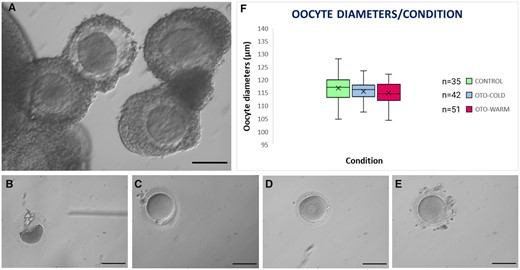 Type of oocytes classified following IVM for 48 h and oocyte diameters. (A) Appearance of healthy COCs collected for IVM. (B) Degenerated, (C) Mature, (D) GV, and (E) MI oocytes following 48 h of IVM. Scale bar: 100 μm. (F) Box plot representing the oocyte diameters of mature Control oocytes and OTO-IVM oocytes of transgender men collected in cold or warm medium. COCs, cumulus oocyte complexes; IVM, in vitro maturation; GV, germinal vesicle; MI, metaphase I; OTO-IVM, in vitro matured ovarian tissue oocytes.