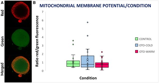 Mitochondrial staining and membrane potential in Control, OTO-Cold, and OTO-Warm oocytes. (A) Mitochondrial staining of a mature oocyte. In the upper panel, mitochondria with high membrane potential emit in red fluorescence. In the middle panel, mitochondria with compromised membrane potential emit in green fluorescence. In the lower panel, is a merged image from red and green channels. (B) Box plot representing the intensity of red/green fluorescence in Control, OTO-Cold, and OTO-Warm oocytes. OTO-COLD, in vitro matured ovarian tissue oocytes from transgender men collected from ovaries transferred in cold medium; OTO-WARM, in vitro matured ovarian tissue oocytes from transgender men collected from ovaries transferred in prewarmed medium.