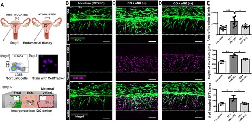 Hormonal stimulation alters the impact of uterine natural killer (uNK) cells on extravillous trophoblast (EVT) invasion. (A) Endometrial biopsies were obtained from unstimulated or stimulated endometrial biopsies (Step 1); uNK cells were identified as live, singlet, and CD45+ cells that express CD56 and lack CD3 (identifying T-lineage cells) by flow cytometry and sorted (Step 2); cells were stained with Cell Tracker (Step 3) and incorporated into gelated ECM within implantation-on-a-chip (IOC) devices containing EVTs and ECs (Step 4). (B) EVTs (green) reached the vascular compartment in 6 days in the presence of ECs (not shown). (C) Addition of unstimulated uNK cells (purple) increased EVT invasion compared to coculture devices. (D) uNK cells from hormonally stimulated endometrium reduced the proinvasive effect of uNK cells. Scale bars = 200 µm. (E) Quantification of area of EVT invasion by pixels (P = 0.001; P = 0.01; n = 9), depth of invasion (P = 0.003; P = 0.03; n = 3), and # of invaded EVTs by area (P = 0.02; P = 0.03; n = 3). *P < 0.05; **P < 0.01;***P < 0.001. Each point represents a single experimental run. Bars represent the standard deviation of the data (P < 0.05). EVTs, extravillous trophoblasts; ECs, endothelial cells; uNK, uterine natural killer; ECM, extracellular matrix; H−, unstimulated; H+, stimulated; CO, coculture.