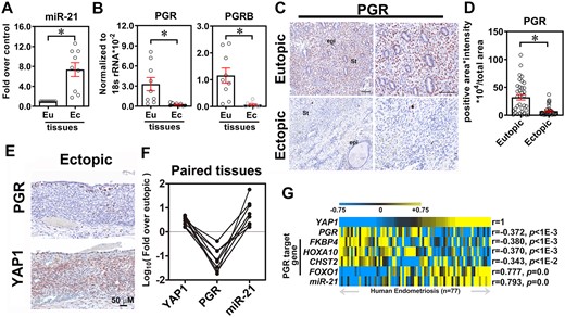 Expression of yes-associated protein 1 (YAP1), miR-21-5p, and progesterone receptor (PGR) in the clinical specimens of endometriosis. Expression levels of miR-21-5p (A) and PGR and PGR-B (B) were quantified in the paired endometrial and endometriotic tissues by qRT-PCR (n = 9 pairs of eutopic (Eu) and ectopic (Ec) samples). Asterisks (*) indicate P < 0.05. Results were presented as mean ± SEM. Representative images (C) and quantified results (D) of PGR in paired Eu endometrial and Ec endometriotic tissues (n = 42). St: stromal cells, Epi: glandular epithelial cells. Asterisk indicates p < 0.05. (E) Representative immunohistochemistry images show the inverse correlation of PGR (upper panel) and YAP1 (lower panel) in Ec endometriotic tissues. (F) Expression levels of YAP1, miR-21-5p, and PGR from the same paired endometriotic specimens were quantified by RT-qPCR. Data were presented as fold over Eu (n = 7). (G) Heat map showed the correlation analyses of YAP1, miR-21-5p, PGR, and its downstream targets in the public dataset (GSE51981) containing a large cohort of endometriotic tissues. Statistical test was performed by using Pearson's correlation test.