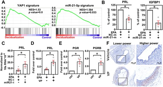 Inhibition of yes-associated protein 1 (YAP1) restores progesterone receptor (PGR) expression and progesterone response. (A) YAP1 and miR-21-5p gene signatures were generated from GSE7700 and GSE52674, respectively. Next, the gene signatures were cross-referenced by the GSEA tool with a dataset of ectopic endometriotic stromal cells treated with or without decidualization reagents (GSE75423). NES: normalized enrichment score. (B) Prolactin and IGFBP1 expression levels were analyzed in normal endometrial stromal cells treated with or without miR-21-5p mimic (50 nM) in the presence of decidualization reagents (EPA) for 6 days (n = 4). Asterisks (*) indicate P < 0.05. (C) Levels of prolactin mRNA in ectopic endometriotic stromal cells treated with EPA with or without control inhibitor (NC-i) or miR-21-5p inhibitor (miR21-i, 50 nM) transfection. Asterisk (*) indicates P < 0.05. (D) Expression of prolactin in ectopic endometriotic stromal cells treated with control or decidualization reagents (10 nM estradiol, 1 μM medroxyprogesterone acetate, and 50 μM cAMP, EPA) for 6 days (n = 4) with or without verteporfin (VP, 61.25 nM) pretreatment. Asterisk (*) indicates P < 0.05. (E) PGR and PGR-B mRNA levels in ectopic endometriotic stromal cells treated with or without VP (61.25 nM) for 6 days (n = 4). Asterisks (*) indicate P < 0.05. (F) Representative immunohistochemistry images show the expression of PGR in ectopic endometriotic lesions derived from mice treated with vehicle or VP (25 mg/kg body weight) for 1 month.