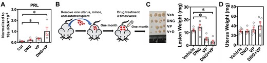Dienogest (DNG) and verteporfin synergistically improve the endometriosis treatment efficacy. (A) Ectopic endometriotic stromal cells were treated with vehicle, verteporfin (VP, 61.25 nM) alone, DNG alone (10−9 M), and combined treatments of VP (61.25 nM) and DNG (10−9 M) for 3 days. Levels of PRL were quantified by RT-qPCR (n = 4). Asterisks (*) indicate P < 0.05. (B) Schematic drawing of autograft and drug treatment protocol. (C) Representative picture (left panel) and quantitative results (right panel) of lesions derived from mice treated with vehicle (Veh), DNG (2 mg/kg body weight), VP (10 mg/kg body weight), and DNG plus VP (V + D). Asterisks (*) indicate P < 0.05. (D) Quantitative results of intact uterine weight from different treatment groups.