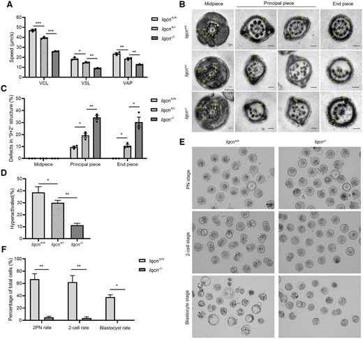 Characterization in Iqcn−/−male mice. (A) VCL, VSL, and VAP of sperm from Iqcn+/+, Iqcn+/−, and Iqcn−/− mice (n = 3). (B) Representative TEM micrographs of defects in the ‘9 + 2’ structure, including disorganized arrangements and/or absence of CPs, peripheral DMTs, and ODFs. Scale bars: 100 nm. (C) The percentages of sperm with defects in the ‘9 + 2’ structure from Iqcn+/+, Iqcn+/−, and Iqcn−/− mice (n = 3). (D) The percentage of hyperactivated sperm from Iqcn+/+, Iqcn+/− and Iqcn−/− mice (n = 3). (E) Representative 2PN zygotes, 2-cell embryos, and blastocysts after IVF with sperm from Iqcn+/+ and Iqcn−/− male mice. Scale bars, 40 μm. (F) Percentage of 2PN zygotes, 2-cell embryos, and blastocysts after IVF in Iqcn+/+ and Iqcn−/− male mice (n = 3). The data are presented as the mean ± SD. *P<0.05, **P<0.01, ***P<0.001 by the independent-samples Student’s t-test (F), one-way ANOVA (A, C, D), Mann–Whitney U-test (F), or Kruskal–Wallis test (C). IQCN, IQ motif-containing N; VCL, curvilinear velocity; VSL, straight line velocity; VAP, average path velocity; TEM, transmission electron microscopy; CP, central-pair microtubule; DMT, peripheral doublet microtubule; ODF, outer dense fiber.