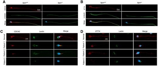 Immunostaining of CDC42 and IFT74 in spermatozoa from mice and humans. (A) Immunostaining of CDC42 (red) and α-tubulin (green) in spermatozoa from Iqcn+/+ and Iqcn−/− male mice. Scale bars, 10 μm. (B) Immunostaining of IFT74 (red) and α-tubulin staining (green) in spermatozoa from Iqcn+/+ and Iqcn−/− male mice. Scale bars, 10 μm. (C) Immunostaining of CDC42 (red) and α-tubulin staining (green) in spermatozoa from normal controls and affected individuals. Scale bars, 5 μm. (D) Immunostaining of IFT74 (red) and α-tubulin staining (green) in spermatozoa from normal controls and affected individuals. Scale bars, 5 μm. IQCN, IQ motif-containing N; CDC42, cell division cycle 42; IFT74, intraflagellar transport 74.
