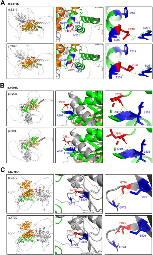 Three-dimensional (3D) structural model prediction of three KCTD19 variants. The 3D structural model of wild type KCTD19 was obtained from the AlphaFold Database (https://alphafold.ebi.ac.uk/) and was analyzed using the PyMol software. Modeling of p.E210K (A), p.P298L (B), and p.G770D (C) mutant KCTD19 proteins. Mutated residues and the corresponding residues connected through hydrogen bonding are shown in red and blue, respectively. The hydrogen bonds are denoted by the yellow dotted lines.