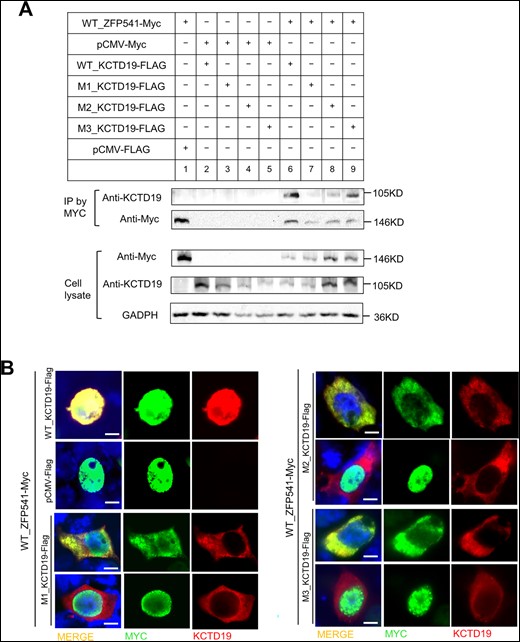 Impact of KCTD19 mutations on protein–protein interaction in vitro. (A) Co-immunoprecipitation assays of the effects of KCTD19 mutations on the binding of full-length KCTD19 to ZFP541 in co-transfected HEK293T cells. (B) Immunofluorescence assay for the expression of wild type (WT) or mutated KCTD19 and ZFP541 in cotransfected HEK293T cells through antibodies against MYC (green) and KCTD19 (red). Scale bars = 5 μm.