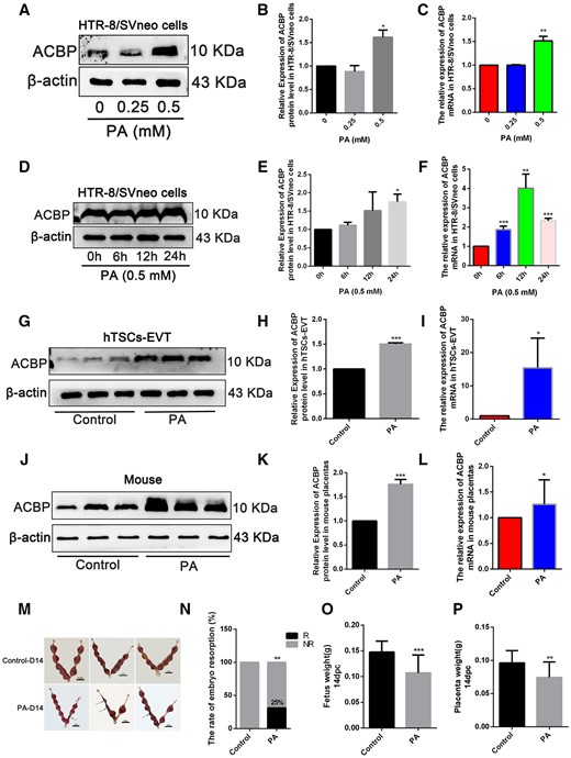 Palmitic acid (PA) exposure upregulated ACBP expression and impaired embryonic development. (A) Western blot of ACBP at 24 h after various concentrations of PA treatment in HTR-8/SVneo cells. (B) Quantified protein levels of ACBP, relative to the protein levels of β-actin. (C) HTR-8/SVneo cells were stimulated with various concentrations of PA, and the mRNA level of ACBP, examined 24 h after the treatment. (D) Western blot of ACBP at 6, 12, and 24h post-treatment with 0.5 mM PA. (E) Quantified protein levels of ACBP at 6, 12, and 24h post-treatment with 0.5 mM PA, relative to the protein levels of β-actin. (F) Quantitative analysis for ACBP mRNA. (G) The protein levels of ACBP detected by Western blot in hTSCs-EVT treated with 0.5 mM PA for 24 h. (H) Quantified protein levels of ACBP, relative to the protein levels of β-actin. (I) Quantitative analysis for ACBP mRNA. (J) Placental ACBP protein levels detected using Western blot. (K) Quantified protein levels of ACBP, relative to the protein levels of β-actin. (L) Quantitative analysis for ACBP mRNA. (M) The uterine appearance on D14 (n=10, Scale bar=1 cm). The black arrow indicates embryo resorption with severe uterine bleeding at D14. (N) Resorption rate of D14 in normal and PA-exposed mice (resorption implantation site per mouse/total implantation site per mouse). (O) Fetus weight (P) Placental weight. *P<0.05, **P<0.01, ***P<0.001. Each result is from three independent experiments.