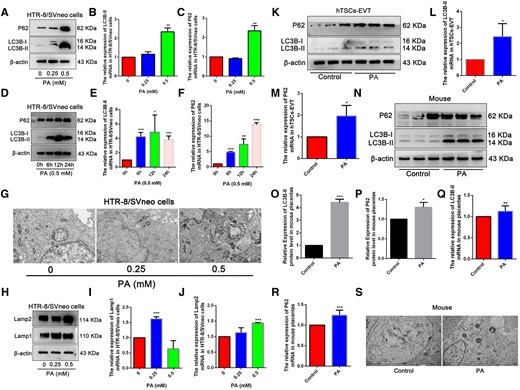 Palmitic acid (PA) exposure caused autophagic dysfunction in vitro and in vivo. (A) The protein levels of LC3B-II and P62 detected by Western blot in HTR-8/SVneo cells treated with different concentrations of PA for 24 h. (B, C) Quantitative analysis for LC3B-II and P62 mRNA by RT–qPCR. (D) The protein levels of LC3B-II and P62 detected by Western blot in HTR-8/SVneo cells treated with 0.5 mM PA for 6, 12, and 24 h. (E, F) Quantitative data of LC3B-II and P62 mRNA expression by RT–qPCR. (G) TEM images of HTR-8/SVneo cells exposed to different concentrations of PA for 24 h. Black arrows indicate autophagosomes. Scale bar: 1 μm. (H) Protein levels of Lamp1 and Lamp2 in HTR-8/SVneo cells exposed to different concentrations of PA for 24 h. (I, J) Quantitative data of Lamp1 and Lamp2 mRNA expression by RT–qPCR. (K) The protein levels of LC3B-II and P62 detected by Western blot in hTSCs-EVT treated with 0.5 mM PA for 24 h. (L, M) Quantitative analysis for LC3B-II and P62 mRNA. (N) Placental LC3B-II and P62 protein levels were detected using Western blot. (O, P) Quantified protein levels of LC3B-II and P62, relative to the protein levels of β-actin. (Q) (R) Quantitative analysis for LC3B-II and P62 mRNA by RT–qPCR. (S) Autophagy in mouse placenta tissue on D14 was observed by using TEM. The black arrow indicates autophagosome with a double membrane structure. Scale bar: 1 μm. *P<0.05, **P<0.01, ***P<0.001 compared with the control group. Each assay was repeated independently for three times.