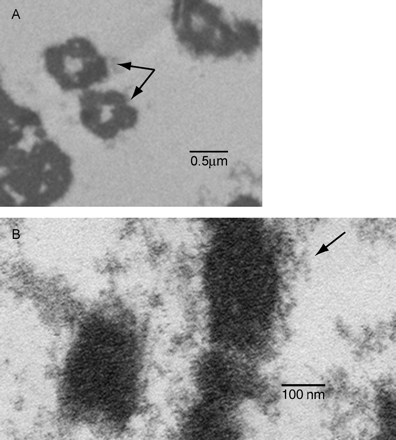 Transmission electron microscopic analysis of maternal plasma pellets. Images display electron micrographs of maternal plasma pellets at two magnifications. (A) Arrows identify the presence of nucleosomes among various structures that are likely ruptured vesicles (apoptotic bodies). (B) Higher magnification illustrates presence of chromatin (arrow).