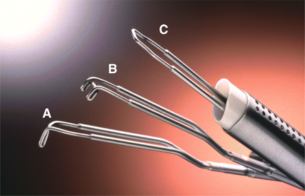 Mazzon’s mechanical loops (Karl Storz GmbH Co) used for ‘cold loop’ myomectomy