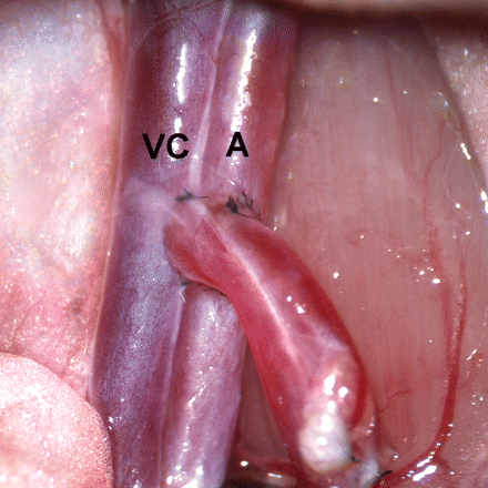 Close up view of end-to-side vascular anastomoses between the common iliac artery and vein of a rat uterus transplant to the vena cava (VC) and the aorta (A) of the recipient rat.