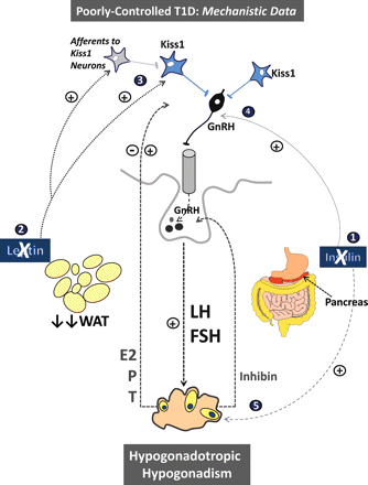 A tentative model of the pathophysiological alterations in the HPG axis that involve the hypothalamic Kiss1 system, as elucidated by mechanistic studies in preclinical models of uncontrolled T1D. A putative sequence of major perturbations observed in this condition is provided. (1) T1D is associated with severely decreased insulin, which induces a catabolic/negative energy balance state that results in medium- and long-term decreases in body weight and a state of hypoleptinaemia (2). Decreased leptin suppresses, either directly or indirectly, the hypothalamic Kiss1/kisspeptin tone (3), which in turn decreases GnRH/gonadotrophin secretion. These conditions define a state of hypogonadotropism that ultimately hampers proper gonadal function (hypogonadism). In addition, the lack of direct insulin action on GnRH neurons may (moderately) contribute to the GnRH secretory disruption in T1D (4). Similarly, the absence of direct trophic insulin action at the ovarian level may participate in the hypogonadism state observed in models/patients with uncontrolled T1D (5). For further details, see Section ‘Metabolic sensing and reproduction: roles of kisspeptins and leptin in T1D and other conditions of metabolic stress’.