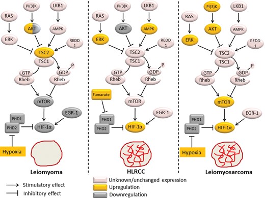 Differential expression of mTOR and HIF-1α pathways between leiomyoma, HLRCC and leiomyosarcoma. Hypoxia up-regulates HIF-1α expression through inhibition of the prolyl hydroxylases PHD1 and PHD2. In addition, hypoxia activates the TSC1/TSC2 (hamartin/tuberin) complex via sensing proteins such as AMPK or REDD1. The TSC1/TSC2 complex functions as a GTPase activator for Rheb, promoting Rheb inactivation. As mTOR activity is dependent on stimulation by Rheb, this leads to mTOR inactivation and resultant down-regulation of HIF-1α protein expression. Thus, the mTOR pathway provides a negative feedback mechanism of HIF-1α activation under hypoxic conditions. mTOR and EGR-1 are potent inducers of HIF-1α activation, and are both down-regulated in leiomyoma tissue, explaining HIF-1α down-regulation despite tumor hypoxia in leiomyomas. Lack of HIF-1α expression is likely responsible for the reduced vascularity of these fibroid tumors. In HLRCC fibroids, accumulation of fumarate due to FH mutation leads to PHD1 and PHD2 inactivation and resultant HIF-1α overexpression, which is likely responsible for the increased vascularity of these tumors. AMPK up-regulation and AKT down-regulation in HLRCC fibroids suggests that mTOR activity is reduced in these tumors. In leiomyosarcoma, up-regulation of AKT and ERK inhibit the TSC1/TSC2 complex, leading to mTOR activation, contributing to tumor progression and metastases. In addition to mTOR activation, hypoxia likely leads to the observed HIF-1α overexpression in leiomyosarcomas, which in turn contributes to the increased vascularity of these tumors. PHD1, prolyl hydroxylase 1; PHD2, prolyl hydroxylase 2; AMPK, AMP-activated protein kinase; REDD1, regulated in development and DNA damage response 1; Rheb, RAS homologue enriched in brain; PI3K, phosphatidylinositol-3-kinase; ERK, extracellular signal-regulated kinase; RAS, rat sarcoma; mTOR, mammalian target of rapamycin; EGR-1, early growth response-1; HIF-1α, hypoxia-inducible factor-1α; FH, fumarate hydratase; HLRCC, hereditary leiomyomatosis.