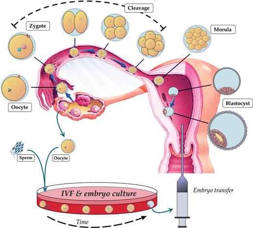 Preimplantation development and IVF. Overview of the stages of preimplantation embryo development from ovulation and fertilization of the oocyte in the oviduct, through cleavage divisions and embryo polarization, to blastocyst formation and implantation into the uterus. In vitro, gametes are isolated for co-incubation, and fertilized zygotes are cultured 3–5 days prior to transfer back into the uterus.
