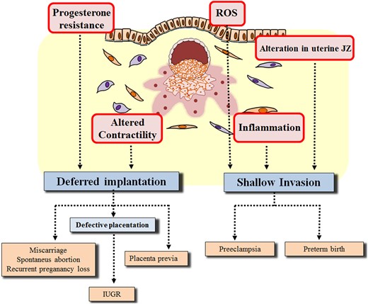 Potential explanations of endometriosis-related adverse pregnancy outcomes based on the model by Cha et al. (2012) implying late-stage disturbances in pregnancy following adverse ripple effect in early stages. ROS, reactive oxygen species; IUGR, intrauterine growth restriction; JZ, junctional zone.