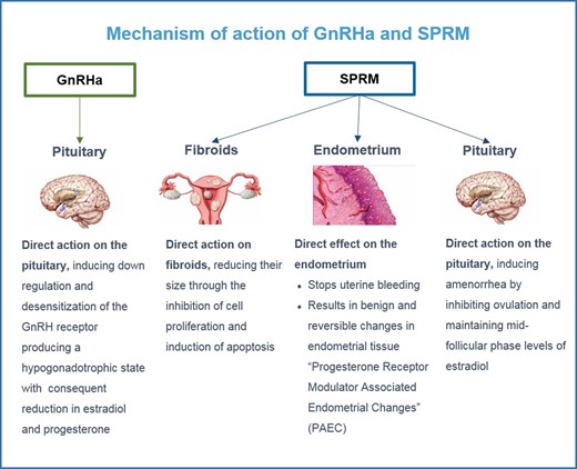 Mode of action of GnRH agonists and SPRMs (Selective Progesterone Receptor Modulators). GnRH agonists have a direct impact on the pituitary. SPRMs have a direct impact on fibroids, endometrium and the pituitary.