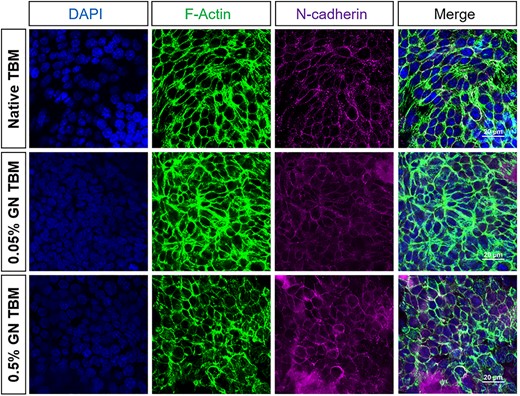 天然和京尼平修饰的TBM上小管上皮细胞DAPI、F-actin和NCAD的免疫荧光成像。所有表面的细胞都显示出极化，表现为顶端肌动蛋白带的形成和NCAD定位到细胞-细胞连接处。