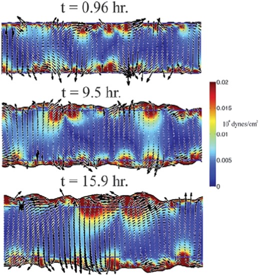 Complex flows and border progression in simulated two-dimensional wound healing assays. A characteristic time course from a simulation with an initial width of 200 μm showing the local velocity of the cells (black arrows) and the traction force exerted against the substrate (colormap). Inside the cell-filled region, the cells move with complex dynamics, which includes vortices and long-range correlations in the velocity field. The border advance is non-uniform and shows characteristics of a fingering-type instability. From Lee et al., 2011 with permission of PLoS Comput. Biol.