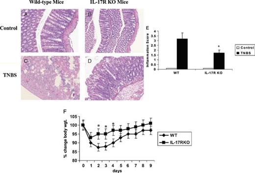 Reduced tissue destruction in IL-17R KO mice after induction of TNBS colitis. Representative hematoxylin and eosin-stained paraffin sections of untreated colons show normal tissue architecture in both WT (A) and IL-17R KO mice (B). C, Representative section of colon from a WT mouse 48 hours after intrarectal TNBS treatment. D, Section of colon of IL-17R KO mouse 48 hours after intrarectal TNBS treatment. E, Colon inflammation was graded on the basis of the criteria listed in Table 1. Results represent mean + SEM of 5 mice. F, Changes in body weight. WT mice or IL-17R KO mice received intrarectal TNBS and weighed daily (n = 8). *P < 0.05 vs control).