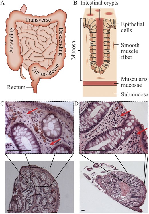 Biopsy histology analysis. A, Overview of the human small and large intestine. B, Cross section of a human colon. Representative H&E-stained colon biopsy slices from (C) control Ctrl_10 and (D) patient UC_05. The crypt architecture is in both slices preserved. However, an increased number of stained cell nuclei surrounding the crypts (red arrows) are apparent in the UC biopsies compared with the control biopsies (scale bars 100 μm).