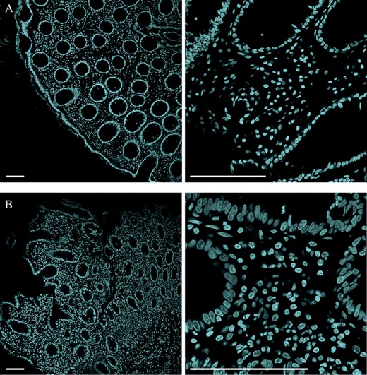 Confocal microscopic images of TO-PRO-3–stained biopsy slices (scale bars 100 μm): (A) Ctrl_5 and (B) UC_3. An increased number of stained cell nuclei surrounding the intestinal crypts are in general apparent in the UC biopsies compared with the control biopsies.