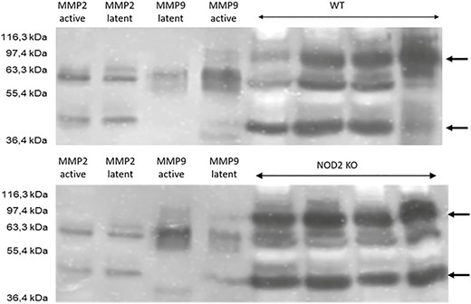 Zymography for the WT (upper panel) and Nod2 KO mice (lower panel) using lysates from anastomotic tissue. Four probes per group were run and compared. The first 4 lanes show standards for active and latent MMP-2 and MMP-9. Unoperated small bowel of the WT and Nod2 KO mice showed the same distribution pattern of MMPs, ruling out a difference in baseline expression between both groups (not shown). The arrows depicts MMP-2 and MMP-9 at 40 kDa and 90 kDa, respectively.