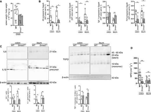 Absence of SMAD7 reduces spleen weight and inflammatory cytokine profile upon DSS-induced chronic colitis. Mice of the same starting weight but different age were used. A, Spleen weight, ±SD, unpaired t test, n as indicated, ***P = .0005. B, Il-6, Il-1β, TGF-β and TNF mRNA expression, ±SD, unpaired t tests, n = as indicated, *P = .0123, .0182, .0182, .0030, and .0367. C, IL-6, IL-1β and TGF-β protein expression, ±SD, unpaired t tests, n = as indicated, *P = .0182, .0422, and .0459. D, MPO, ±SD, unpaired t tests, n = 8, 7, 8, 7, **P = .0099.