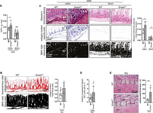 Absence of SMAD7 is increasing fibrosis upon DSS-induced chronic colitis. Mice of the same starting weight but different age were used. A, HYP content, ±SD, unpaired t tests, n = 8, 7, 8, 7, *P = .0103. B, Collagen content visualized by Sirius red staining was quantified with the Fiji software, ±SD, unpaired t test, n = 8, 7, *P = .0339. C, Collagen content visualized by Masson’s trichrome staining was quantified with the Fiji software, ±SD, unpaired t tests, n = 5, 6, 5, 6, *P = .0053. D, ColIVa1 mRNA expression, ±SD, unpaired t test, n = 8, 7, *P = .0366. E, Submucosal thickness, mm = muscularis mucosae, mp = muscularis propria, ±SD, each data point represents the average of five individual measurements from a representative area, unpaired t test, n = 5, 6, *P = .0045.