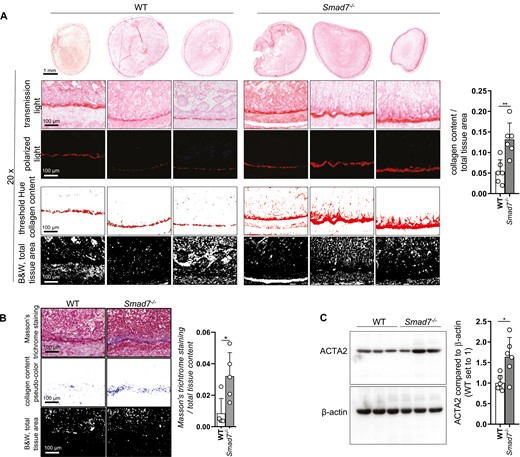 Absence of SMAD7 reduces deposition of collagen in the heterotopic transplantation model. A, Collagen content visualized by Sirius red staining was quantified with the Fiji software, ±SD, unpaired t tests, n = 6 each, **P = .0031. B, Collagen content visualized by Masson’s trichrome staining was quantified with the Fiji software, ±SD, unpaired t tests, n = 5 each, *P = .0177. C, ACTA2 protein expression and densitometry, n = 6 each, ±SD, unpaired t test, n = 6 each, *P = .0113.