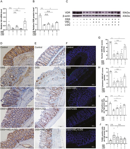 Comparison of vitamin D receptor (VDR) expression, proliferation, and apoptosis in the colonic epithelia of Vdr+/+ mice treated with vitamin D3 (VitD3) or Lactobacillus rhamnosus GG (LGG). A, Colonic Vdr messenger RNA (mRNA) levels by quantitative real-time polymerase chain reaction (qRT-PCR) with Gapdh as the internal reference, n = 5. B, Quantitative analysis of relative colonic VDR protein levels with β-actin as an internal reference, n = 3. C, Colonic VDR protein expression by Western blotting, n = 3. D, Colonic VDR protein expression by immunohistochemistry (IHC) (×200). E, Colonic Ki-67 expression by IHC (×200). F, Colonic apoptotic cells were stained using the terminal deoxynucleotidyl transferase mediated dUTP nick end labeling (TUNEL) assay (×40; TUNEL staining, green; and DAPI staining, blue). Semi-quantitative analysis of (G) colonic epithelial nuclear VDR protein expression, (H) colonic epithelial cytoplasmic VDR protein expression, (I) Ki-67 expression, and (J) TUNEL-positive cells (n = 4). Data shown are mean ± SEM. P > .05 was considered nonsignificant (n.s.). *P < .05, **P < .01, ***P < .001. DSS, dextran sulfate sodium.