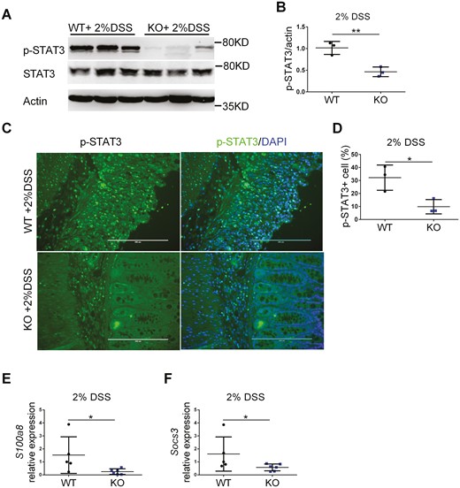 Myeloid cell-specific FTH1 knockout mice show inhibited STAT3 activation during colitis. A, Western blot analysis of p-STAT3 Y705 in colon tissues and (B) quantification. C, Immunofluorescence staining of p-STAT3 in colon tissues and (D) quantification. Quantitative PCR analysis of (E) S100a8, (F) Socs3 expression in colon tissues. *P < 0.05, **P < 0.01, Unpaired Student t test.
