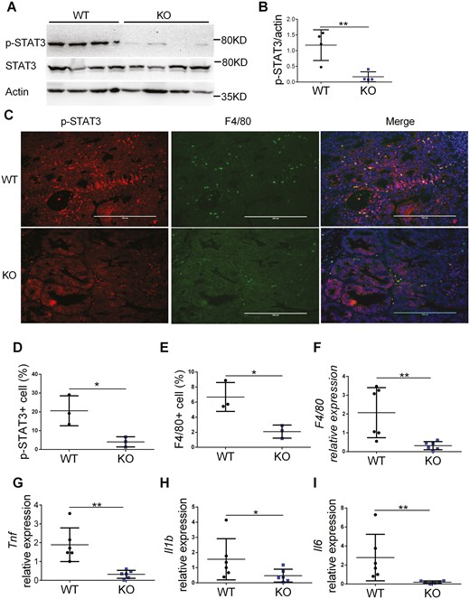 Tumors from myeloid-specific FTH1 knockout mice show reduced STAT3 activation and inflammation. A, Western analyze of p-STAT3 and (B) quantification of p-STAT3 in tumor tissues of WT and KO mice. C, Immunofluorescence staining of p-STAT3 and F4/80 in WT and KO colon tumors, quantification of p-STAT3(D) and (E) F4/80 positive cells. Quantitative PCR analysis of (F) F4/80, (G) TNF, (H) IL-1b, (I) IL-6 expression in colonic tumor tissues of WT and KO mice. *P < 0.05, **P < 0.01. Unpaired Student t test.