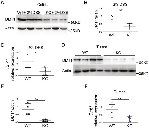 Myeloid cell-specific FTH1 knockout mice show repressed DMT1 expression in inflamed and tumor colon tissues. A, Quantitative PCR analysis, (B) Western blot analysis, and (C) quantification of DMT1 expression in inflamed colon tissues. D, Quantitative PCR analysis, (E) Western blot analysis, and (F) quantification of DMT1 expression in colorectal tumor tissues. *P < 0.05, **P < 0.01. Unpaired Student t test.