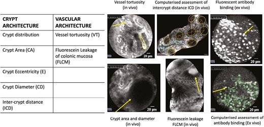 Summary of probe confocal laser endomicroscopy findings in vivo and ex vivo.