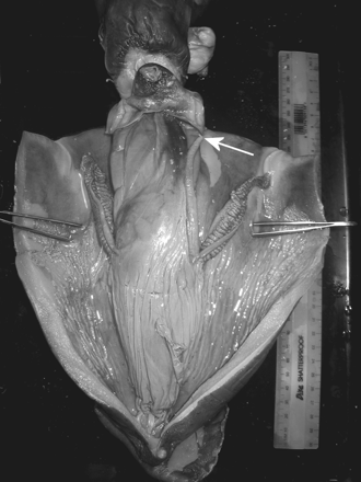 Opened mantle of H. miranda, in ventral view. The opening of the terminal organ is indicated by a white arrow. The ruler on the right side of the animal is 300 mm long.