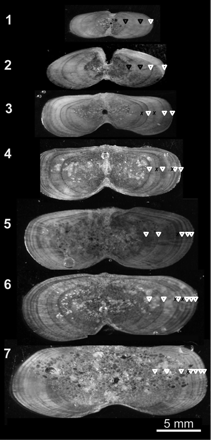 Images of typical dorsal fin-spine sections from striped marlin in the SWPO. Illustrations show annulus counts (white triangles), false increments (black crosses), and annuli replaced because of vascularization of the core. False annuli corroborated by otolith daily microincrement counts are denoted by black triangles.