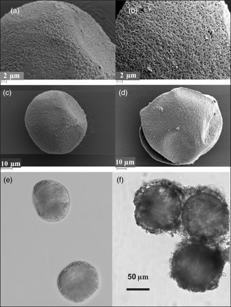 Egg morphology by optical and SEM techniques. Appearance of eggs produced (a, c, and e) mainly during the period of peak population growth and (b, d, and f) during the period of population decline. (e and f) Optical images. (a–d) Details of the chorion surface under SEM.