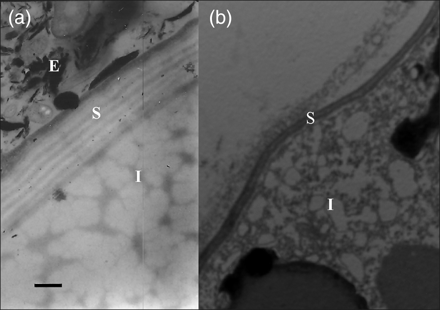 Egg morphology by the TEM technique. Appearance of eggs produced during the period of (a) population decline, and (b) population growth. E, outer envelope of egg; S, inner layer of egg shell; I, egg interior. Scale bar = 0.5 µm.