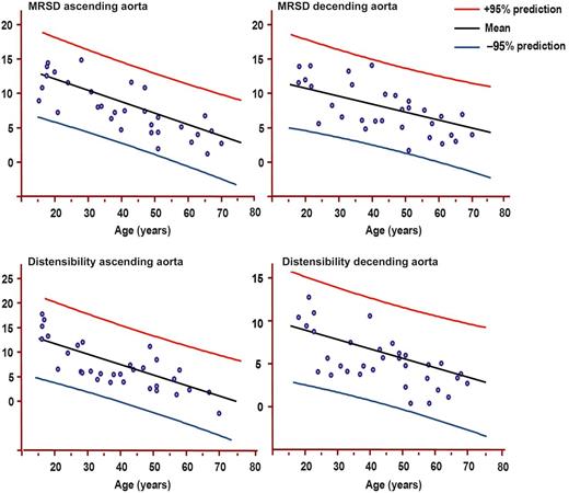 Females: Maximum rate of systolic distension (MRSD) of ascending and descending and distensibility of ascending and descending aortas by age decile (mean, 95% prediction). MRSD is expressed as percentage of maximal area/10–3 s. Distensibility is expressed as 10–3 mmHg–1.