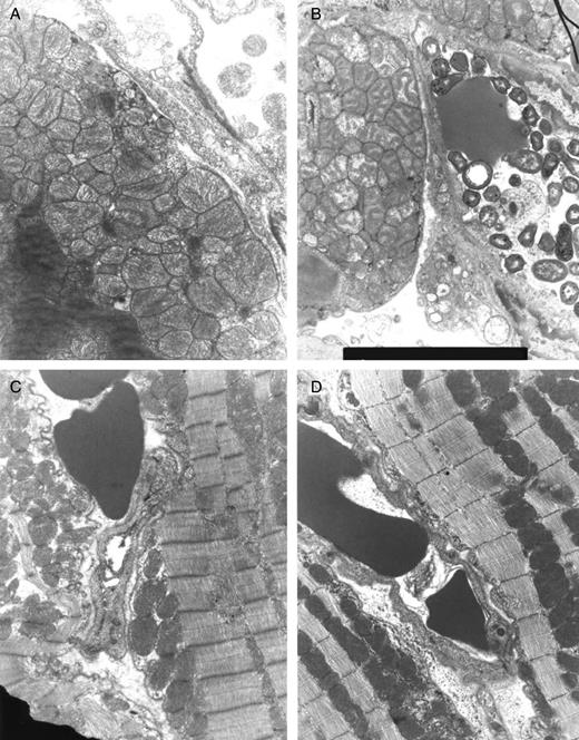 Representative micrographs of transmission electron microscopy at the end of ex vivo reperfusion. (A) HTK, (B) HTK-N, (C) HTK-N + S-NO-HSA, (D) in vivo S-NO-HSA.