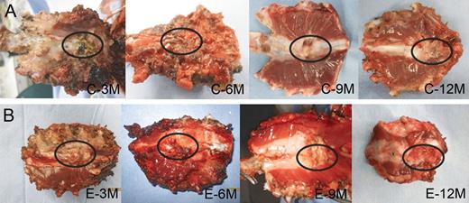 Macroscopic images (the mediastinal side) of the specimens (the regenerated chest wall tissue) in the control group (A) and in the experimental group (B). Dense connective tissue (encircled) filled the bony defect in all specimens of the control group and the experimental group. C: the control group; E: the experimental group; 3–12M: 3–12 months postoperatively.