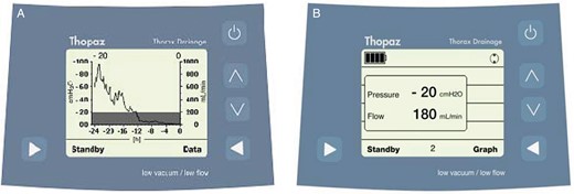 (A) The digital system in graph mode displays the air leak volume over time (ml/min; thin line) and intrapleural pressure (cmH2O; grey bars). (B) The digital system in data mode displays the pressure applied to the pleural space and current air leak flow. This model records 40 patient-days of data. (Image printed with permission from: Thopaz, Medela, Baar, Switzerland)