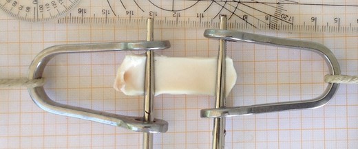 Aortic strips with a width of 15 mm were mounted in a custom-made tensile tester using surgical clamps. Force-dependent distension was measured optically.