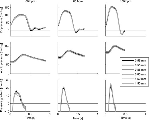 Aortic and left ventricular pressures and trans-valvular pressure gradients for all measurements showing the ensemble-averaged heartbeats.