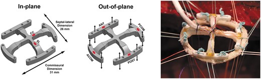 Mitral annular force transducer marked with outer dimensions and red markings for strain gauge positions for in-plane (left) and out-of-plane (middle) force measurements. The transducer was preattached to an annuloplasty ring with separate sutures prior to implantation (right). ANT: anterior; POST: posterior; ACOM: anterior commissure; PCOM: posterior commissure; SL: septal-lateral; CC: commissure to commissure.